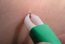 vytažení klíštěte